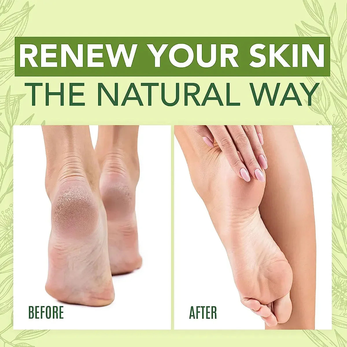 Foot Cream Moisturiser for Dry Feet and Heels