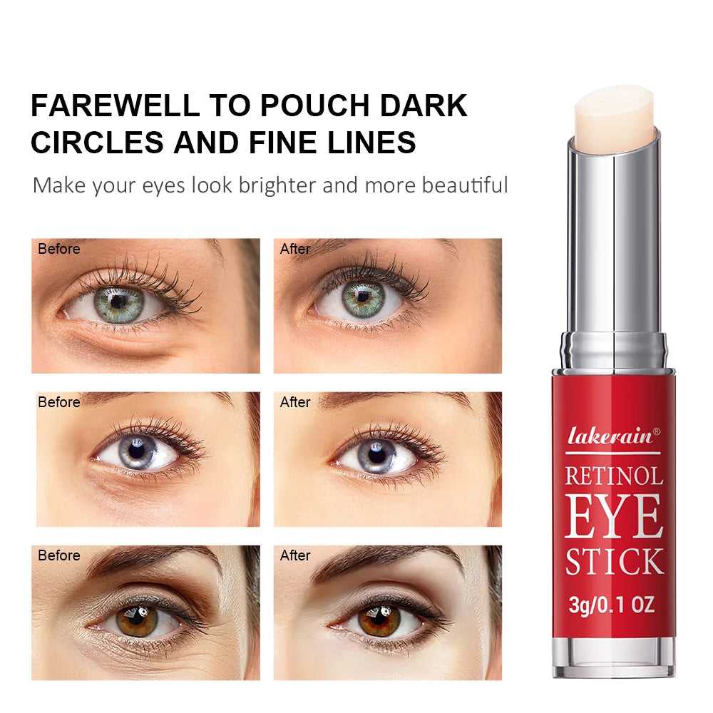 Retinol Eye Cream